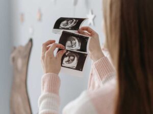 what to expect at 7 week ultrasound